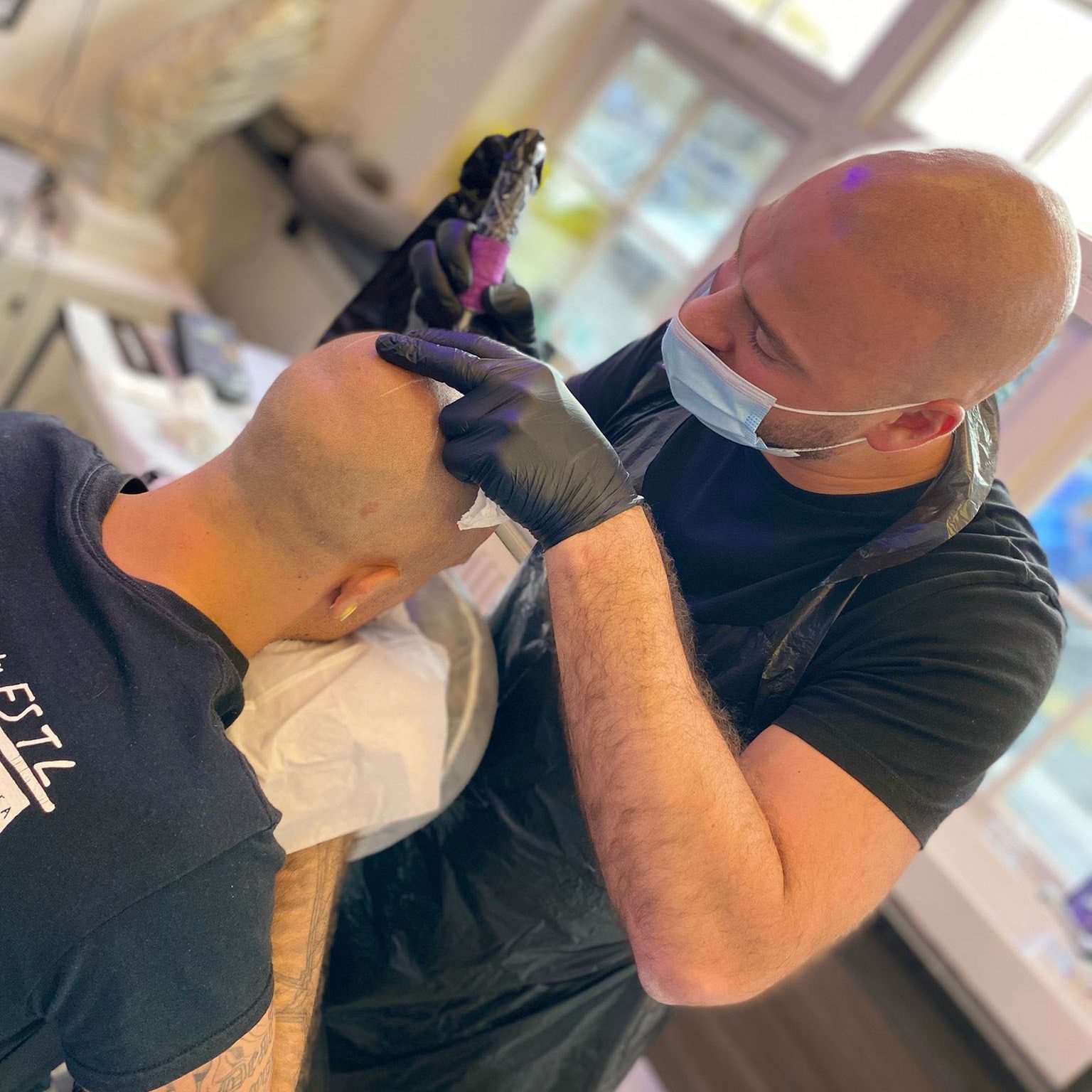 Scalp Micropigmentation Client Treatment